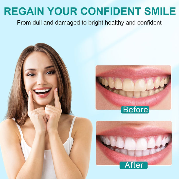 Munddusche Kabellos Trragba Elektrische 320ML Wassertank Zahndusche IPX7 Wasserdicht für Oral Health