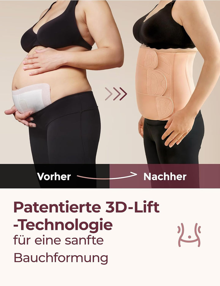 momcozy Ergowrap Bauchgurt nach Geburt, 3D-Kompression &amp; Rückenstütze für Kaiserschnitt-Rückbildung,