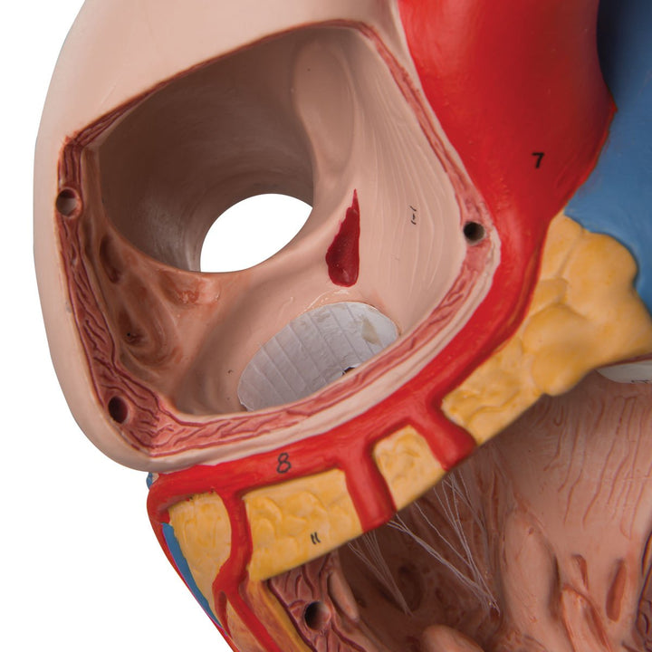 3B Scientific Menschliche Anatomie - Herzmodell, 2-fache Grösse, 4-teilig + kostenlose Anatomie App