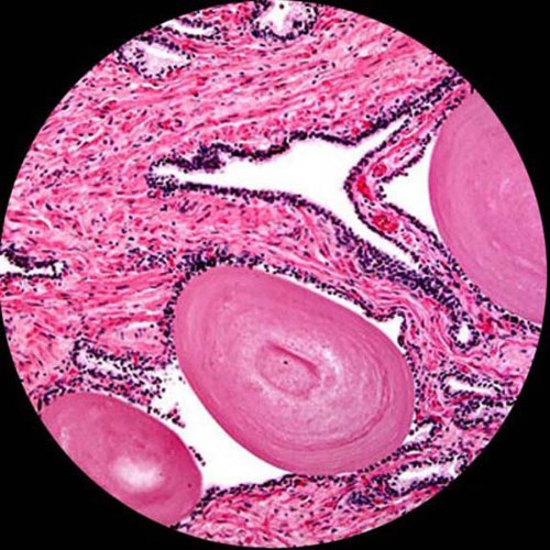 AmScope MU1000A 10MP Digitalmikroskopkamera für Stand- und Videobilder, 40-fache Vergrösserung, 0,5-