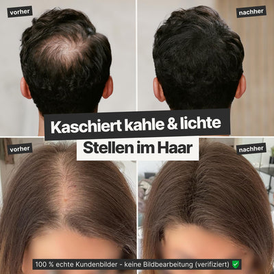 IMPERIO Streuhaar zur Haarverdichtung & vollem Haar in Sekunden. Schütthaar für einen authentischen