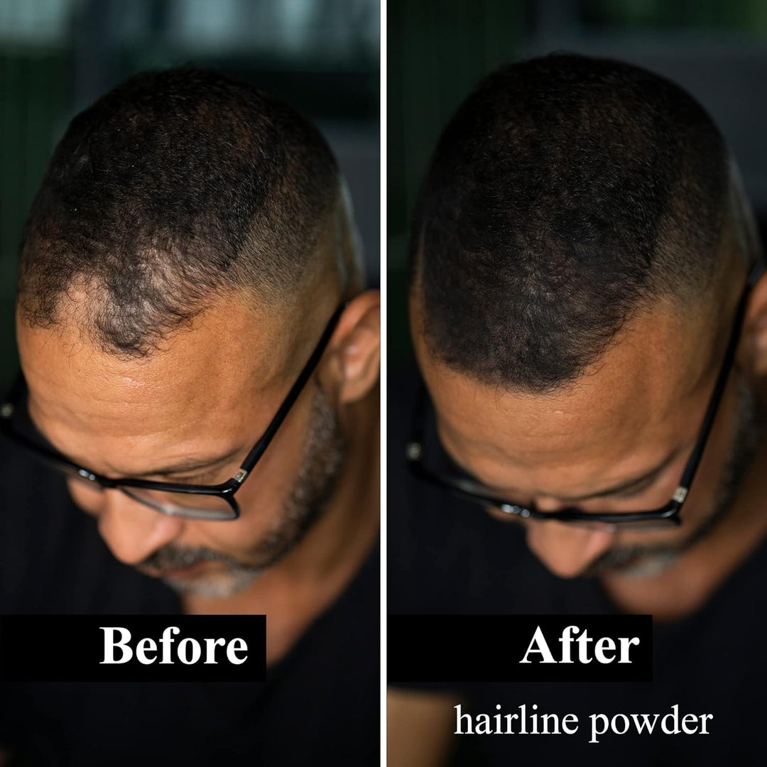 LEON MIGUEL Hair Fiber - Streuhaar - Premium Haarverdichtung/Schütthaar mit Soforteffekt bei Geheimr