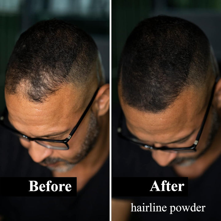 LEON MIGUEL Hair Fiber - Streuhaar - Premium Haarverdichtung/Schütthaar mit Soforteffekt bei Geheimr