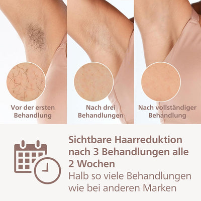 Philips Lumea IPL 9000 Serie, 3 Aufsätze – Haarentfernungsgerät