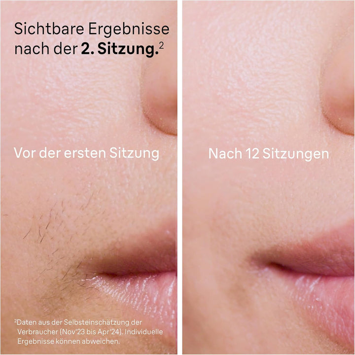 Braun IPL Silk·expert Pro 5 – IPL Haarentfernungsgerät, Dauerhafte und Schmerzfreie Haarentfernung f