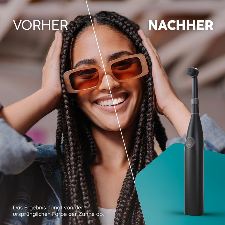 happybrush® Aufsteckbürsten für elektrische rotierende Zahnbürsten - Kompatibel mit R2, sowie Modell