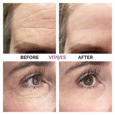 VITAYES Instant Ageback - Anti Aging Creme, Soforteffekt gegen Falten, Tränensäcke und schlaffe Haut