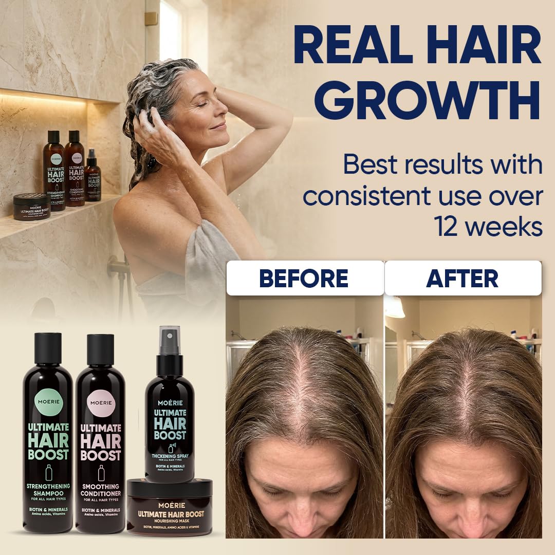 MOERIE Shampoo Set - gegen Haarausfall, Conditioner, Haarwachstum Serum & Haarmaske - natürlich Haar
