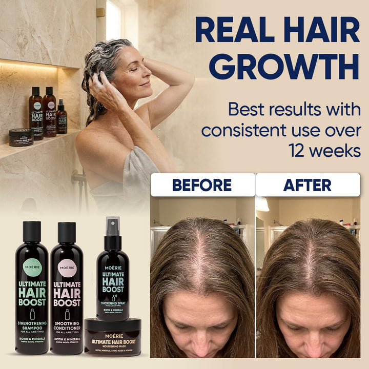 MOERIE Shampoo Set - gegen Haarausfall, Conditioner, Haarwachstum Serum & Haarmaske - natürlich Haar
