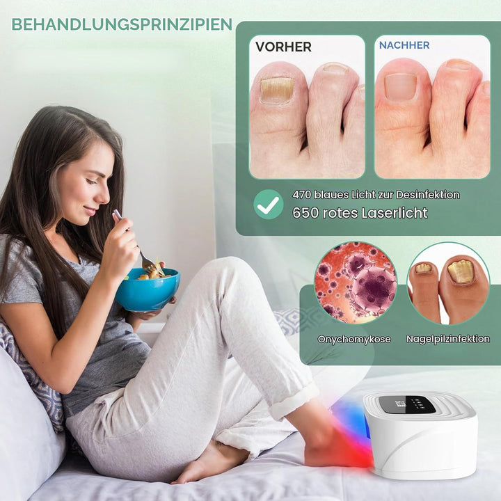 iKeener Kabellose Nagelpilz Lasergerät,FDA Zulassung Nagel Reinigung Fingernägel &amp; Onychomykose,15*4