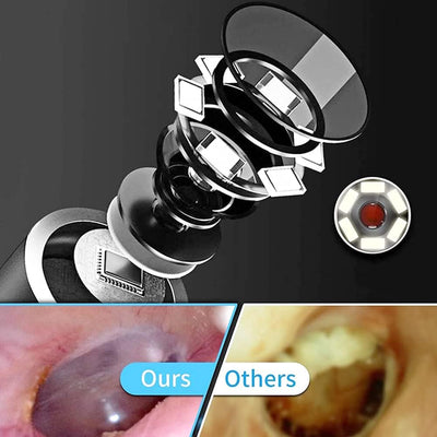 SANON Ohrenschmalz Entferner Otoskop, Otoskop Ohrreiniger, Ohrenschmalz Entferner HD Kamera mit 6 Di