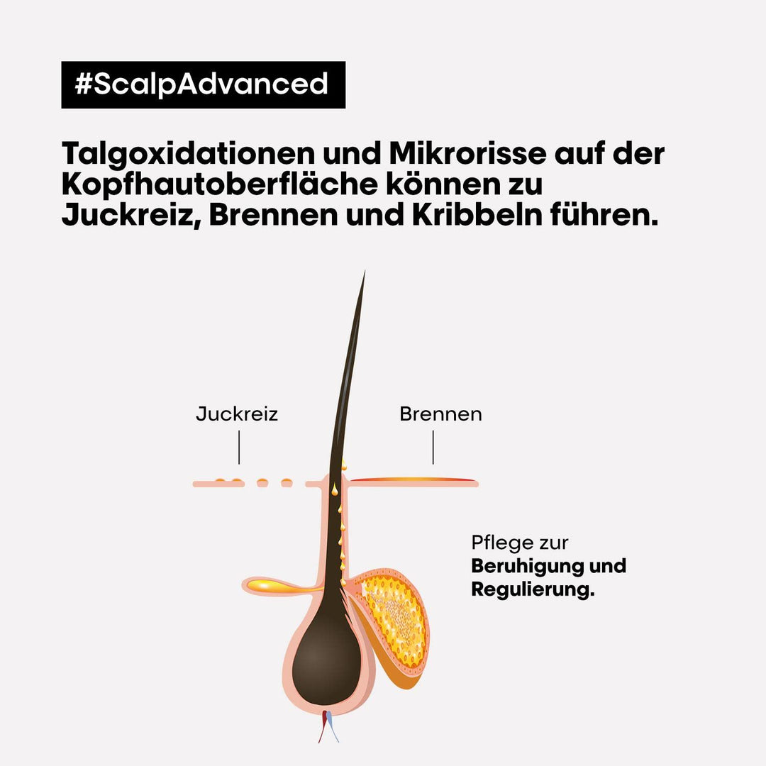 L'Oréal Professionnel Pflegeset zur Beruhigung sensibler Kopfhaut, Scalp Advanced, Anti-Discomfort D