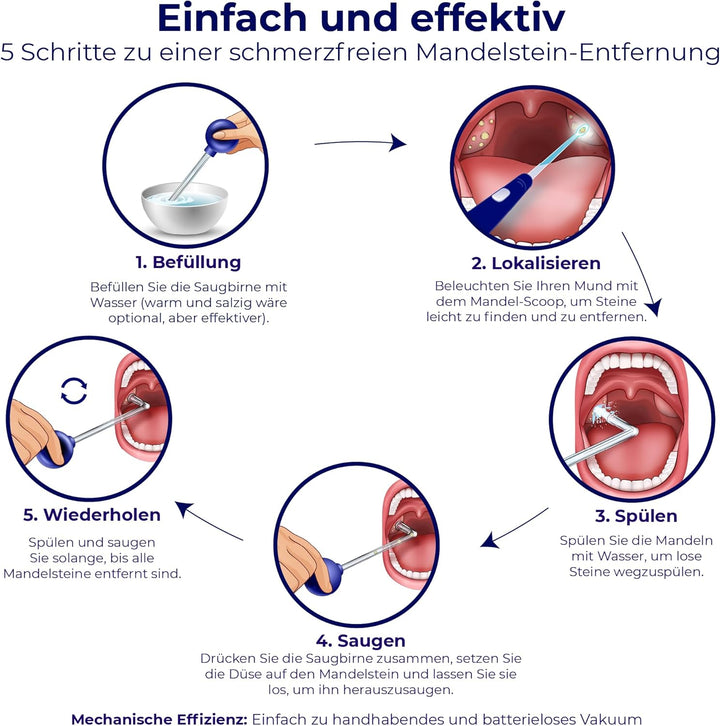 Oravix Mandelsteine Schröpfglas, Mandelsteine Entfernen Sauger, Mundgeruch Bekämpfen, Mandelstein En