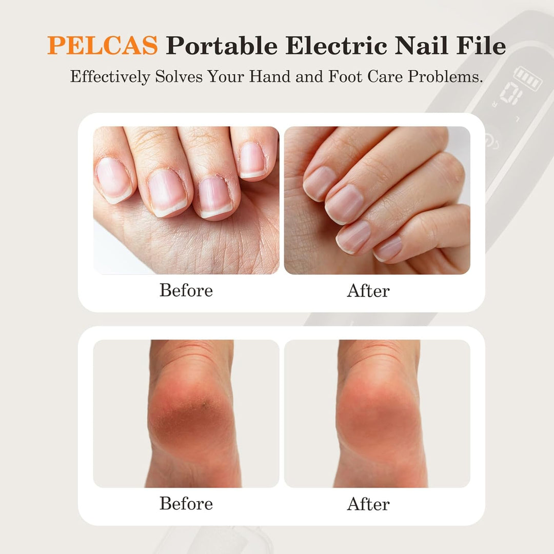 PELCAS Elektrische Nagelfräser 10 Geschwindigkeiten Schnurloser Nagelbohrer Professionell Nagelschle