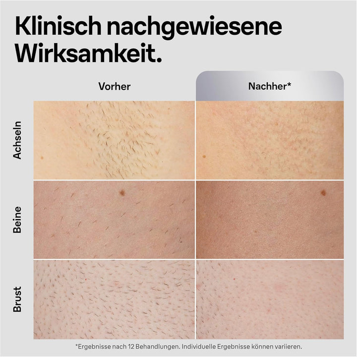 Braun IPL Silk Expert Pro 5 Haarentfernungsgerät Herren, sichtbare Haarentfernung für Männer, Design