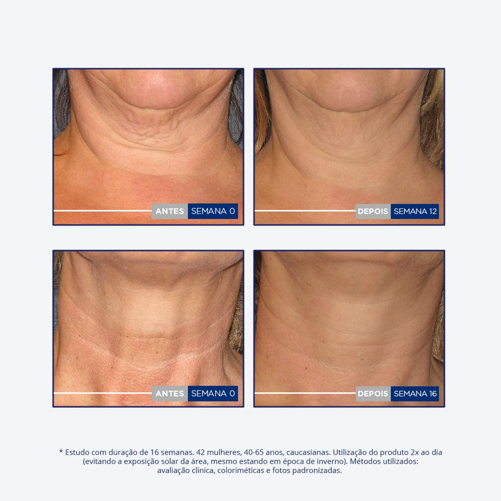 Neostrata Skin Act Reaf Cuello Escot 80G