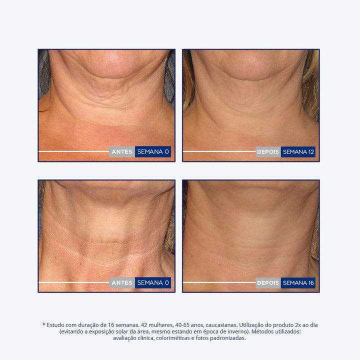 Neostrata Skin Act Reaf Cuello Escot 80G