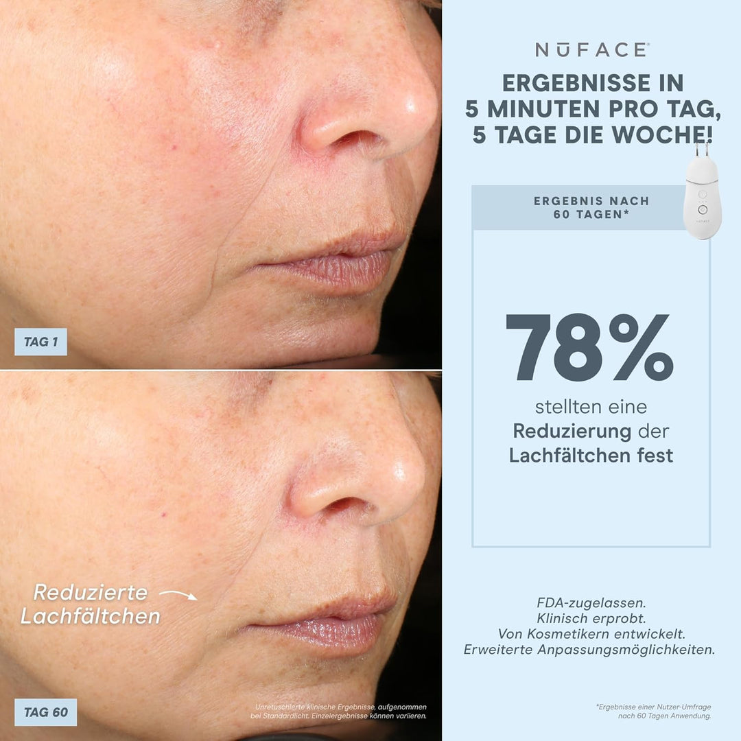 NuFACE TRINITY+ Effective Lip & Eye Attachment Trinity+ Wirksames Lippen- und Augenzubehör, Trinity+