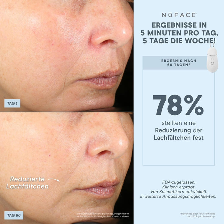 NuFACE TRINITY+ Effective Lip & Eye Attachment Trinity+ Wirksames Lippen- und Augenzubehör, Trinity+
