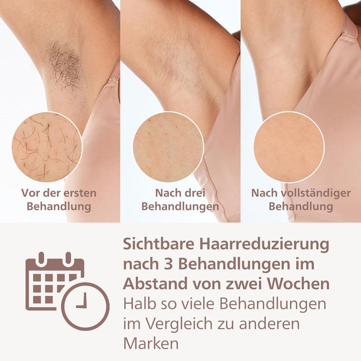 Philips Lumea IPL Prestige, 4 Aufsätze – Haarentfernungsgerät