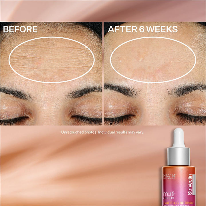 StriVectin SUPER-C RETINOL brighten&correct vitamin C seru 320755 orange 30 ml (1er Pack) Multi-Acti
