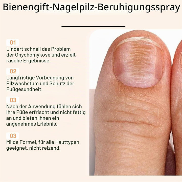Propolis Nagelserum, Bienengift Nagel-Reparatur Spray, Sanfte Pflege Eingewachsener Nägel und Sauber