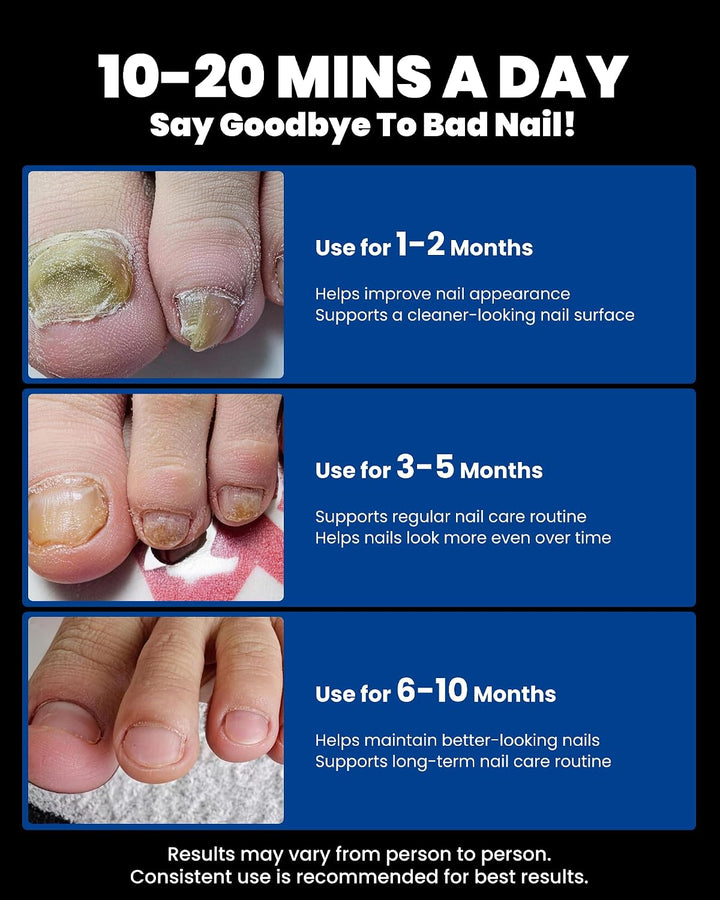 Wiederaufladbare Nagelpflege Lichtgerät - Blaues &amp; Infrarotlicht für Nagelhygiene &amp; Aussehpflege - T