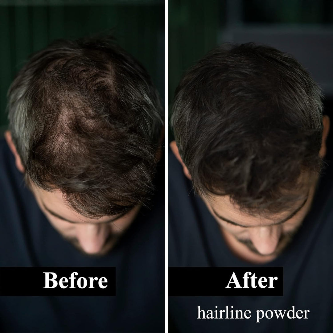 LEON MIGUEL Hair Fiber - Streuhaar - Premium Haarverdichtung/Schütthaar mit Soforteffekt bei Geheimr