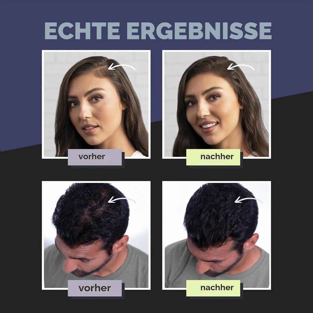 Toppik Haarfasern 55 g, Hellbraun, natürlich gewonnene Fasern aus Keratin für voller aussehendes Haa