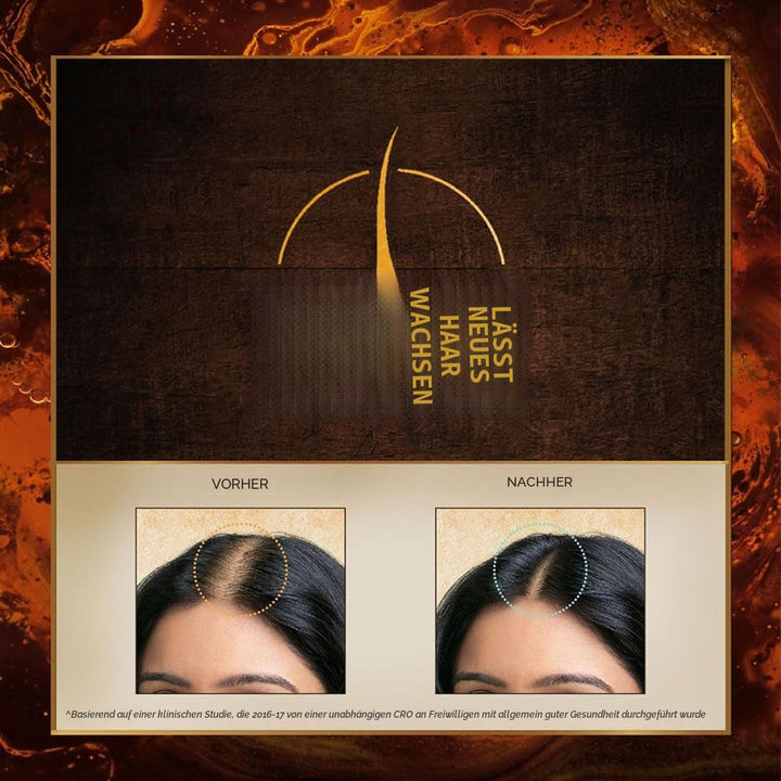 Indulekha Bhringa Haaröl, 100 ml, aus Indien, 2 Stück 200 ml (1er Pack), 200 ml (1er Pack)