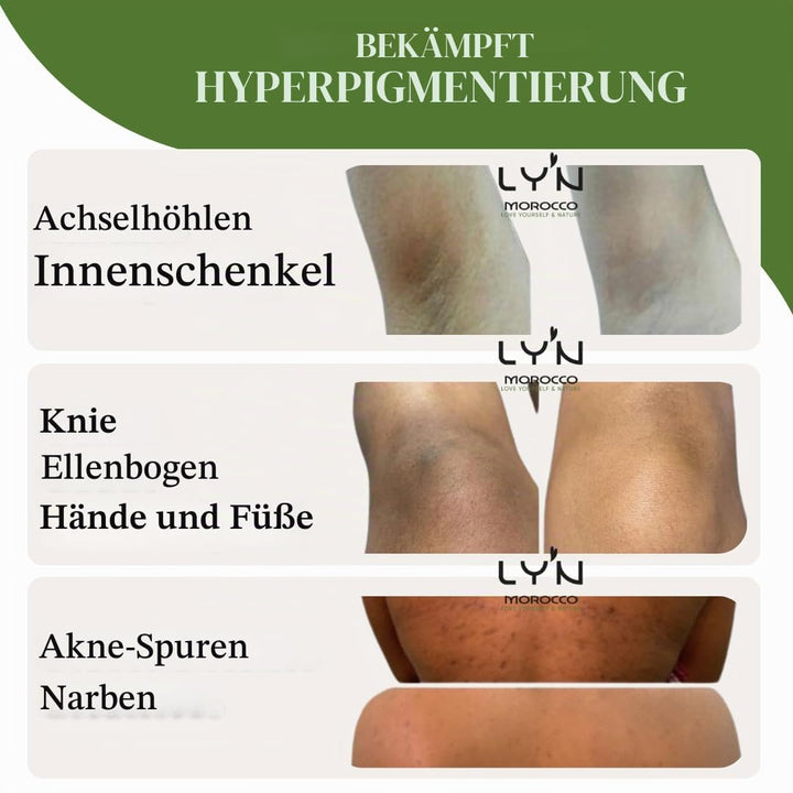 Ly'n Morocco TABRIMA SAHRAOUIA NILA und Weihrauch männlich Körpermaske Exfoliant für Knie, Ellbogen,