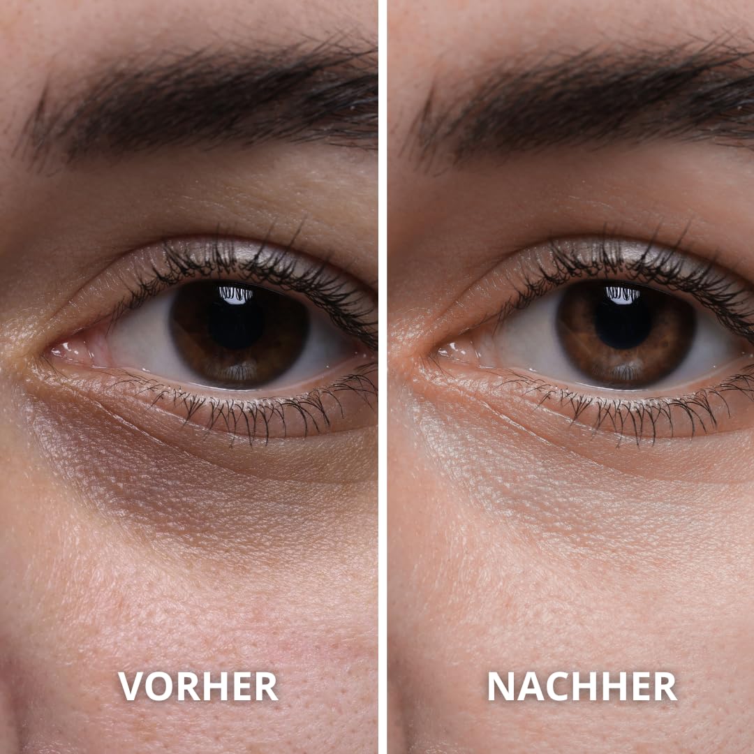 Bio Kaktusfeigenkernöl 100% Rein und Natürlich - Kaltgepresst, Extra Natives Öl - Pflege für Haut, G
