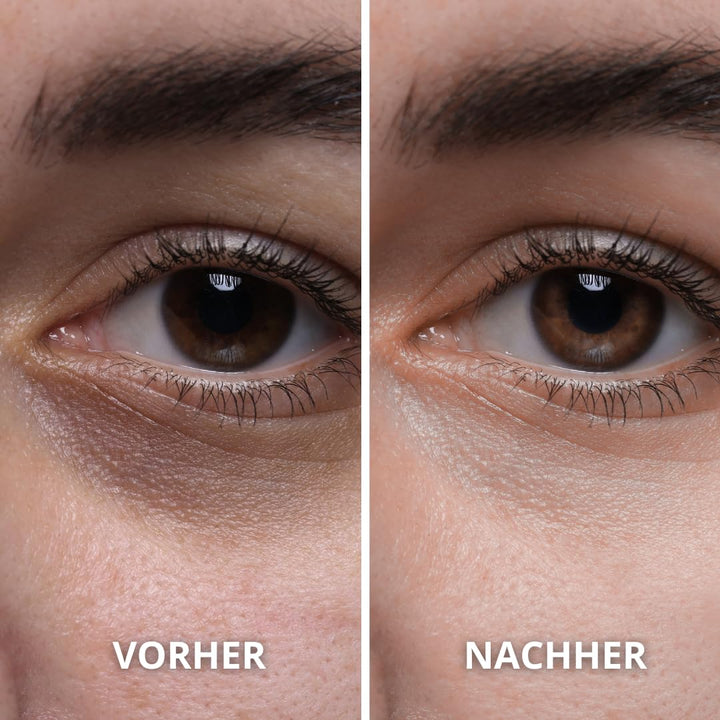 Bio Kaktusfeigenkernöl 100% Rein und Natürlich - Kaltgepresst, Extra Natives Öl - Pflege für Haut, G