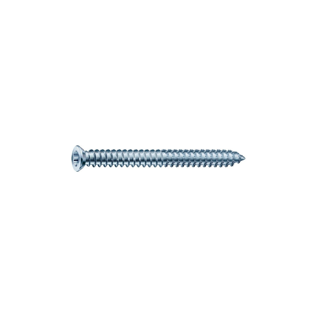 SPAX 1021010751505 RA Rahmenanker 7.5x150 Senkkopf Torx30 verzinkt für dübellose Verschraubung 100 S