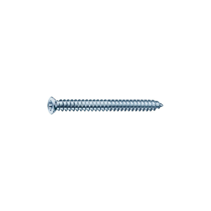 SPAX 1021010751505 RA Rahmenanker 7.5x150 Senkkopf Torx30 verzinkt für dübellose Verschraubung 100 S