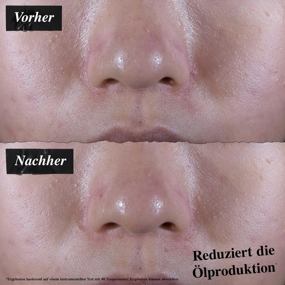Ultra Gesichts-Gel-Creme für normale bis fettige Haut, ölfrei, 125 ml