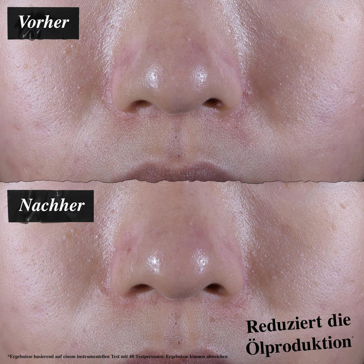 Ultra Gesichts-Gel-Creme für normale bis fettige Haut, ölfrei, 125 ml