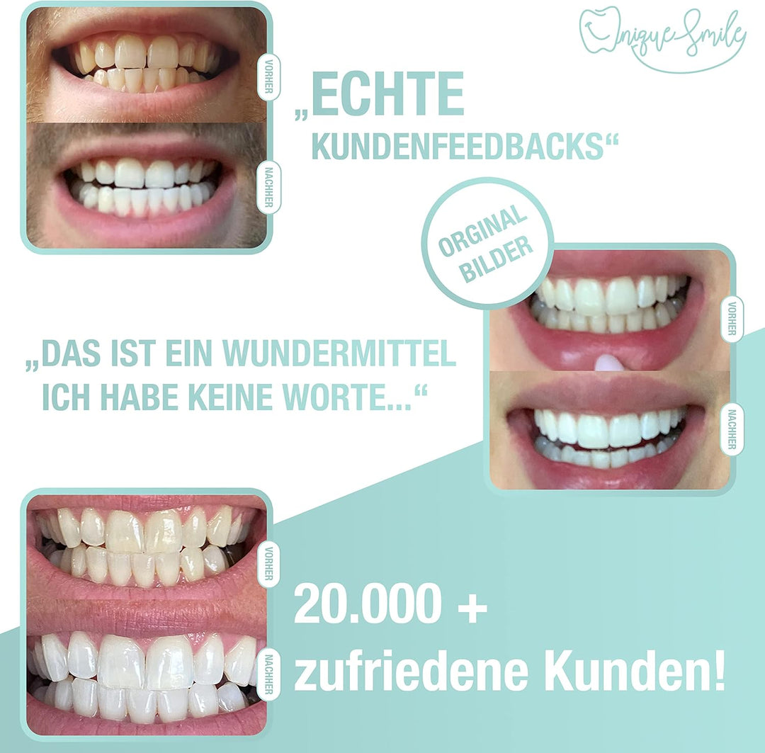 Hochwertiges Teeth whitening kit von UniqueSmile - All in One Bundle für Zahnaufhellung & weisse Zäh