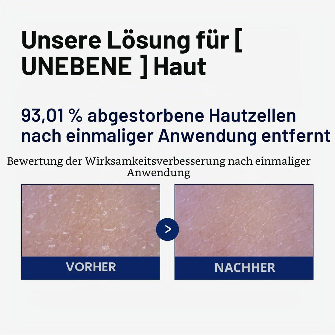 MEDIHEAL Phyto Enzym-Peeling-Pad – Vegane Gesichtserneuerung Gaze-Pads mit LHA & Papaya Enzym – Pore