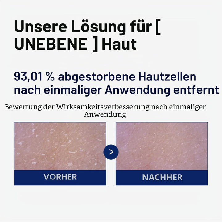 MEDIHEAL Phyto Enzym-Peeling-Pad – Vegane Gesichtserneuerung Gaze-Pads mit LHA & Papaya Enzym – Pore