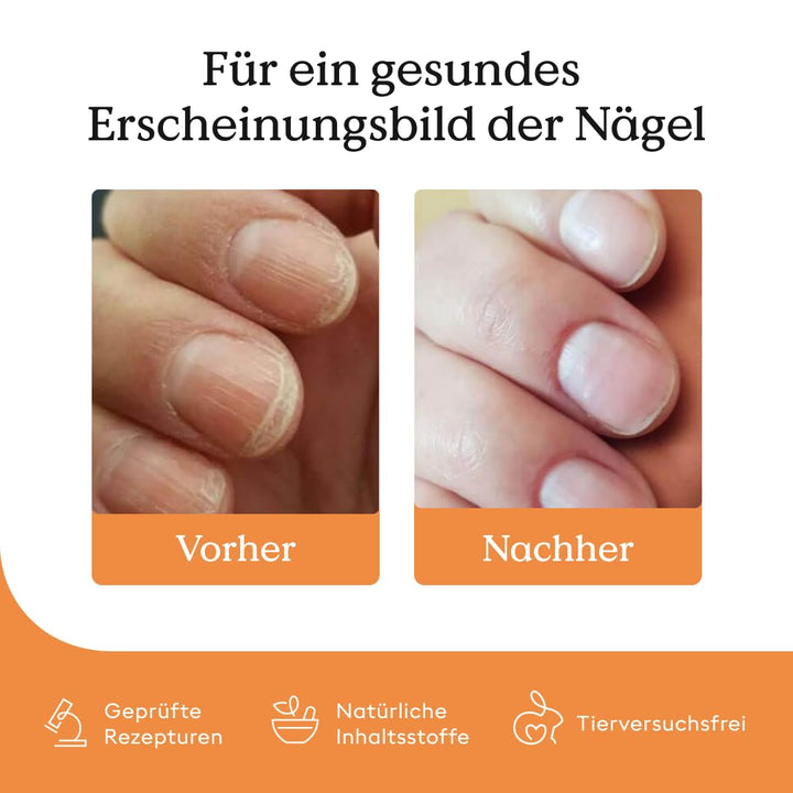 Health Routine Nail Growth Serum 3er Set — Nagelöl für gesunde Fingernägel & Fussnägel — Schnelles W