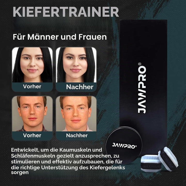 Jawliner 6 Stück Kiefertrainer Geruchloses Silikon für Männer und Frauen für Anfänger, Zwischenhändl
