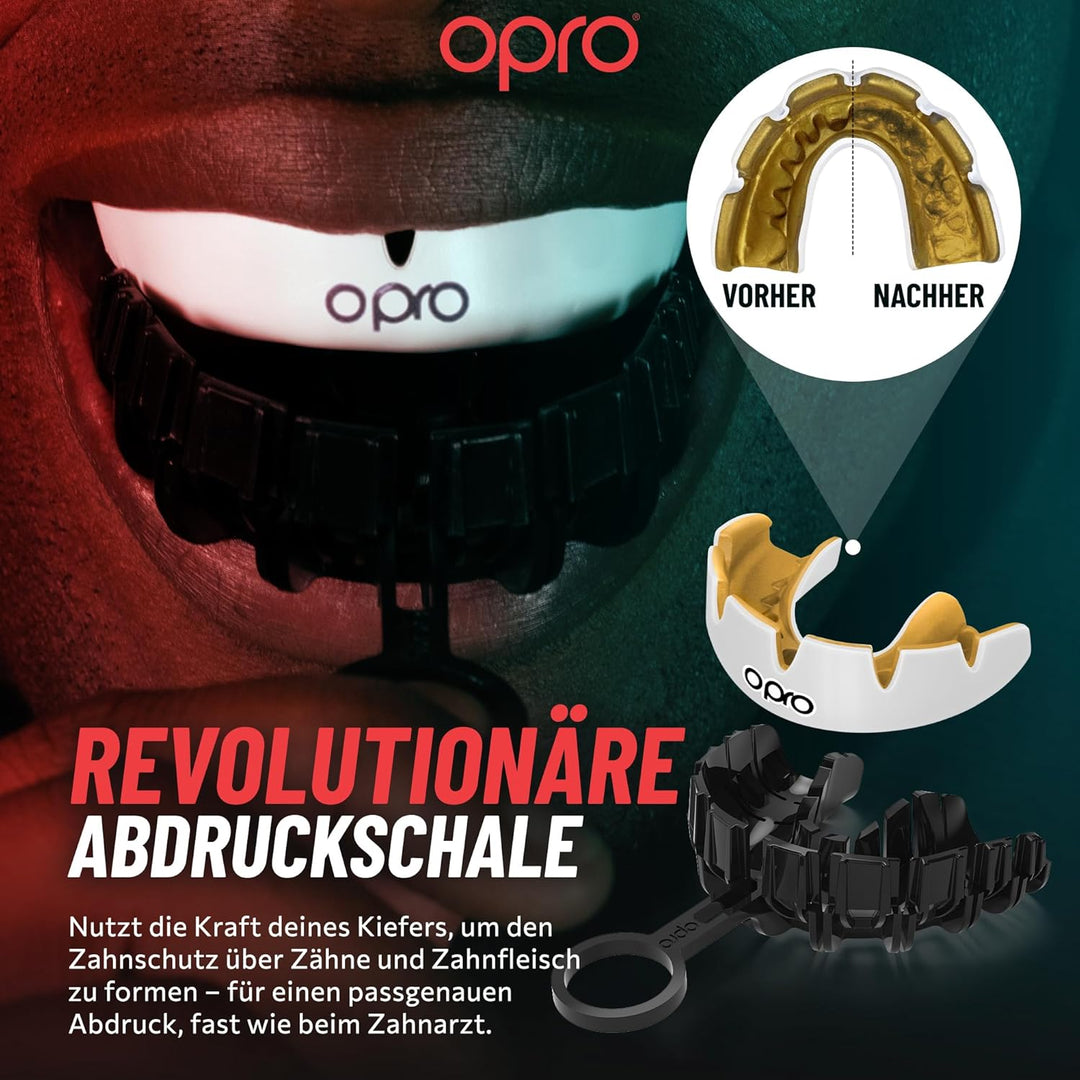OPRO Sofortige individuelle Hosenträger, Zahnarzt-Mundschutz mit revolutionärem Käfig, ultimativer K