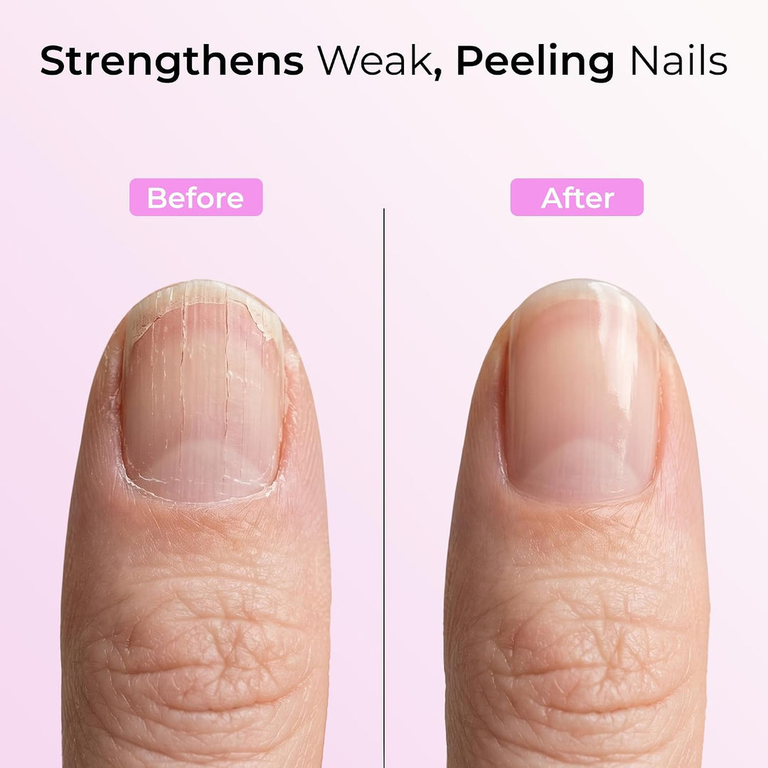 ORLY Nagel-Reparatur Set - mit Brush-On Nail Glue, Nail Repair Powder und Polierfolie - schnelle und