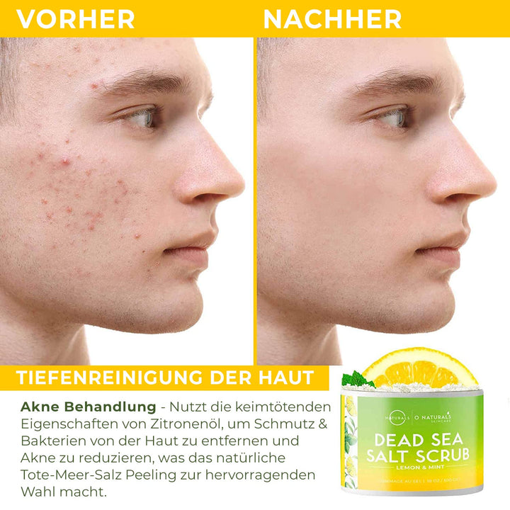 Ultra Körperpeeling Body Scrub Lemon Mint 510g - Natürliches Körperpeeling mit Totem Meer Salz - Feu