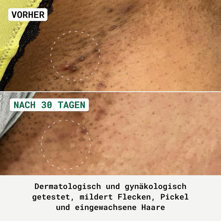 NUBIANCE - Melintim 75ml - Multi-Comforting Creme für äussere Intimbereiche - Nach dem Wachsen oder