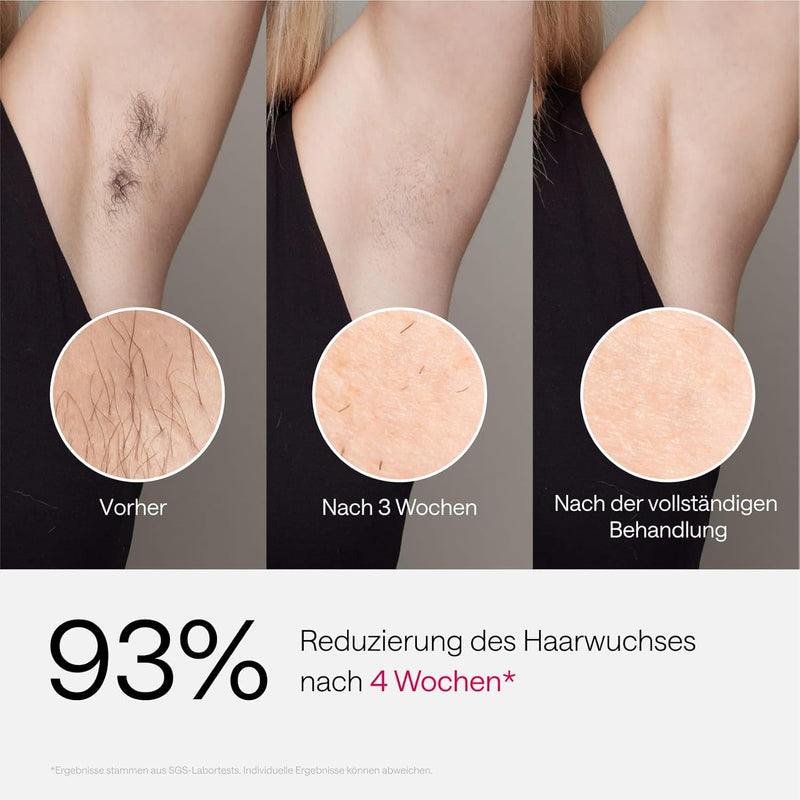 Ulike Air 3 Laser-Haarentfernung für Frauen & Männer,IPL Haarentfernungsgerät mit Saphir-Eiskühlsyst