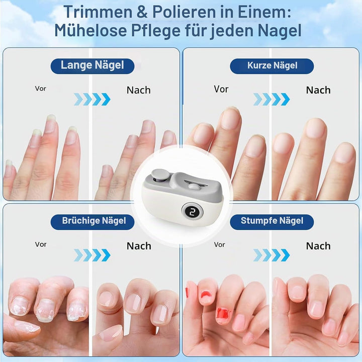 Elektrischer Nagelknipser, 3-in-1Elektrische Nagelfeile, Multi-Functional Nagelschneider Elektrischm