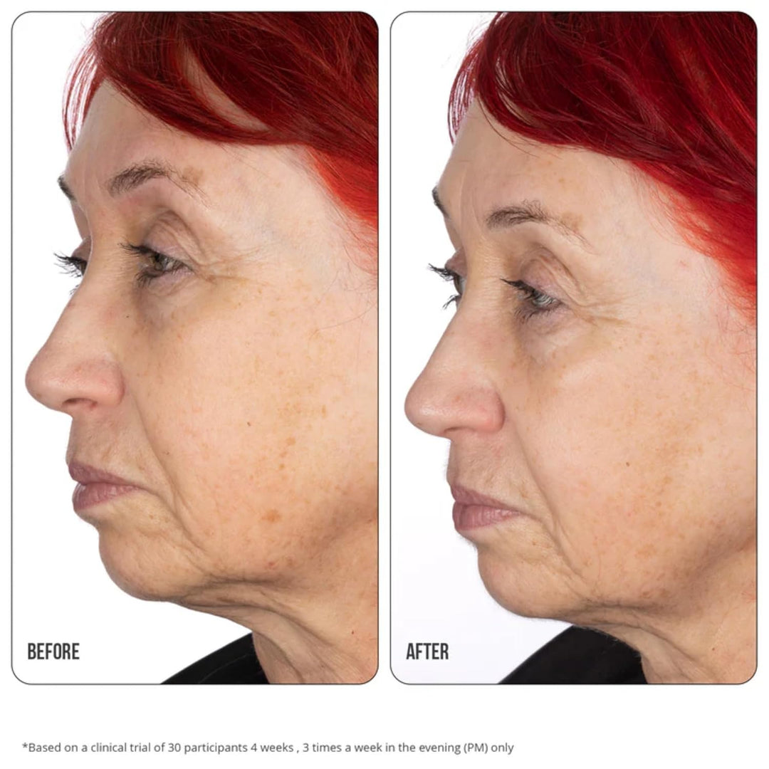 Nip+Fab Retinol Fix Concentrate Extreme 10% - Next-Generation Solution for Youthful Skin with Time-R