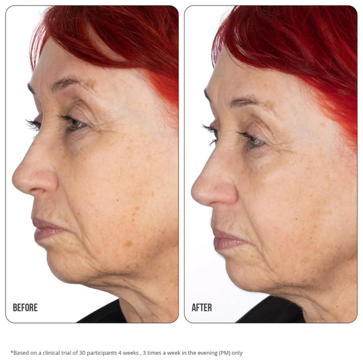Nip+Fab Retinol Fix Concentrate Extreme 10% - Next-Generation Solution for Youthful Skin with Time-R